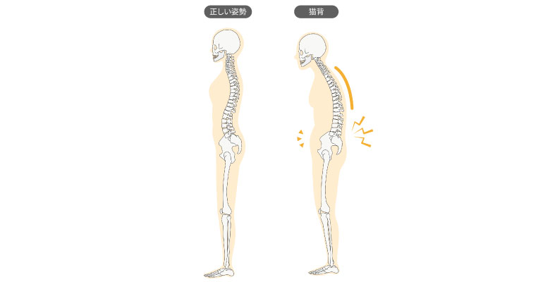 正しい姿勢と猫背