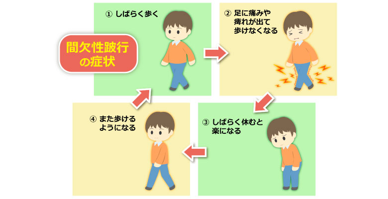 歩くと腰が痛い人のセルフチェック|あなたの腰痛タイプは?