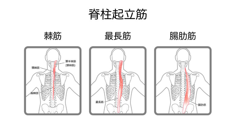 脊柱起立筋の過緊張
