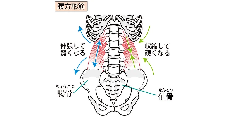 腰方形筋
