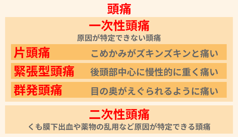 頭痛の分類（一次性頭痛・二次性頭痛 / 片頭痛・緊張型頭痛・群発頭痛）